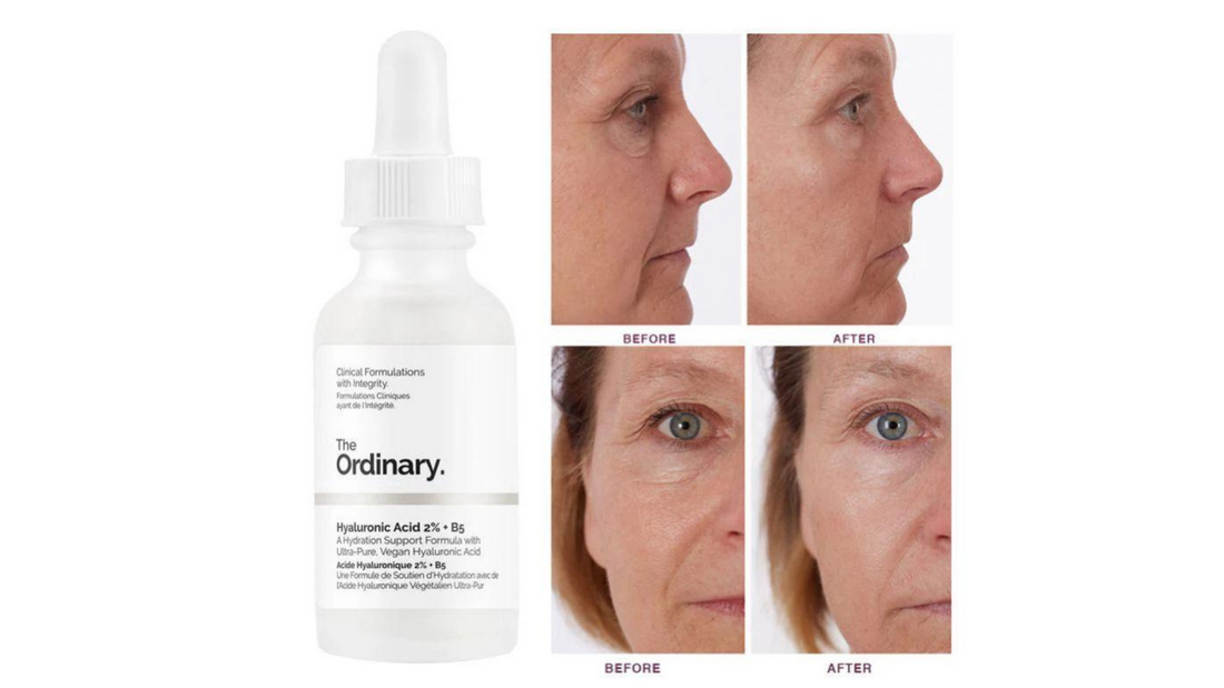 the ordinary hyaluronic acid