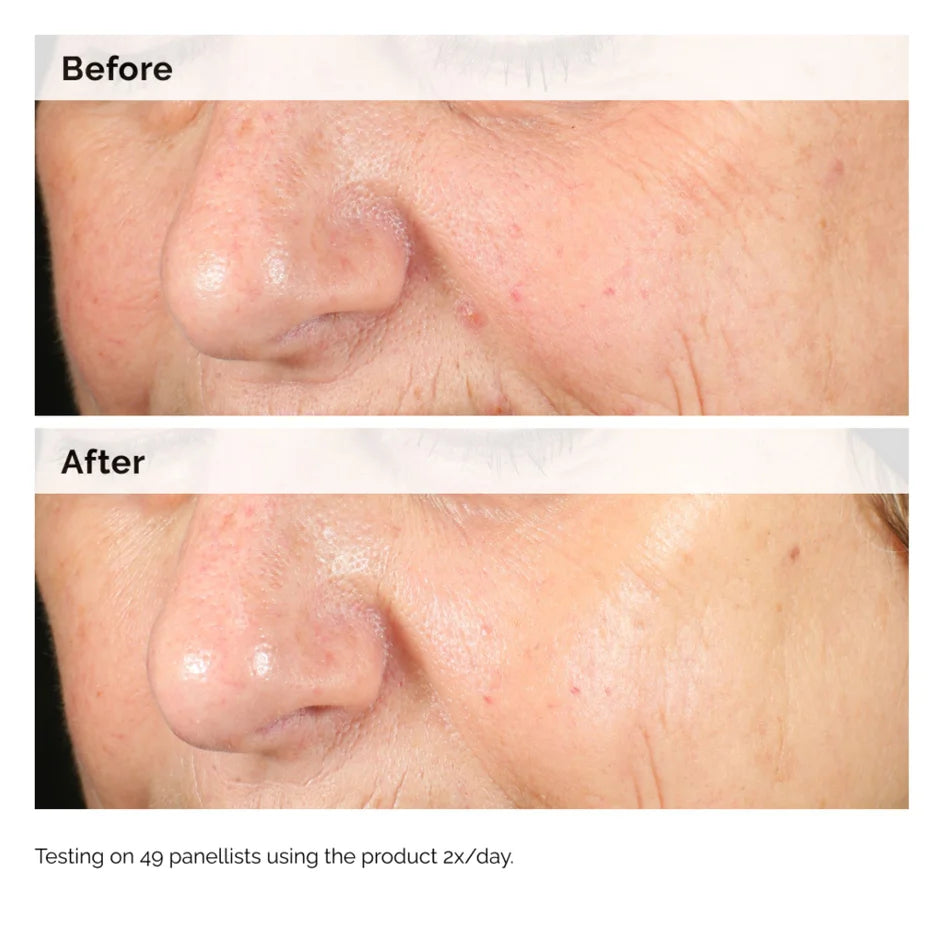 The Ordinary Alpha Arbutin 2% + HA 30 ml