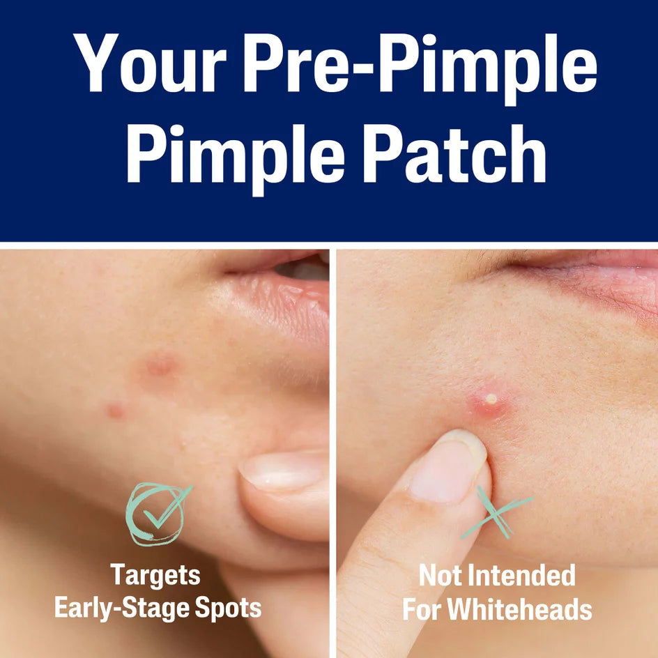 Cetaphil Gentle Clear 6 Hour Fast Clear Pimple Patches (24 Patches)