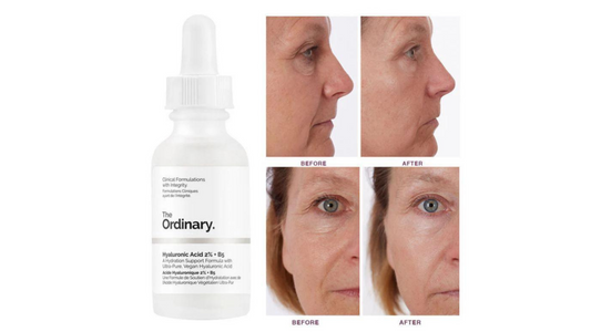 the ordinary hyaluronic acid
